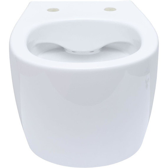 Унитаз приставной безободковый Allen Brau Fantasy 4.11004.20 с тонкой крышкой микролифт - фото 2