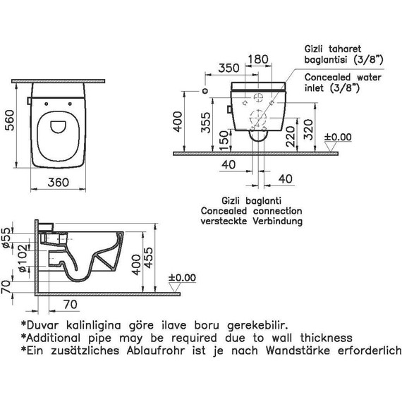 Унитаз-биде подвесной безободковый Vitra Metropole 7672B003-1687 - фото, картинка 8 Унитаз-биде подвесной безободковый Vitra Metropole 7672B003-1687 - фото 8