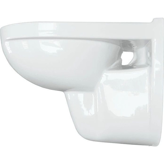 Унитаз подвесной Sanita Luxe Best WC.WH/Best/DM/WHT.G/S1 с крышкой микролифт - фото, картинка 4 Унитаз подвесной Sanita Luxe Best WC.WH/Best/DM/WHT.G/S1 с крышкой микролифт - фото 4